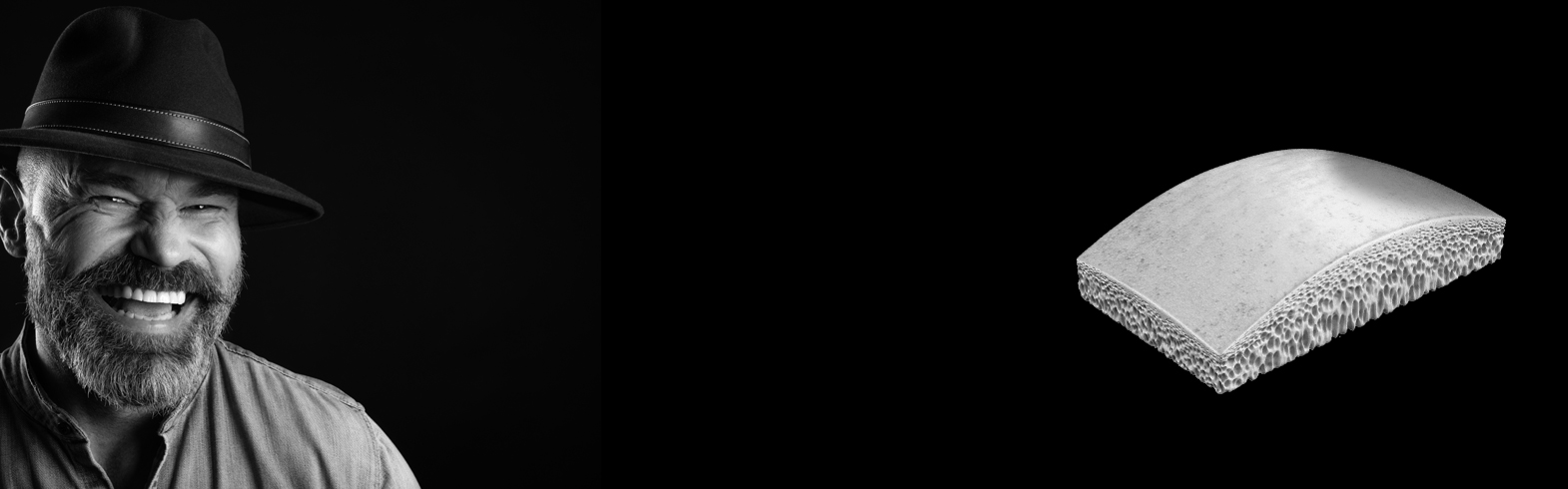 Formes Géométriques de greffons osseux allogéniques - BIOBank