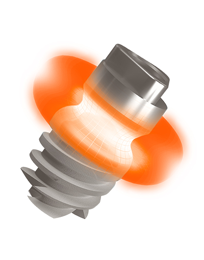 Système Implantaire twinKon®4 - implant court dentaire, implant ultra-court