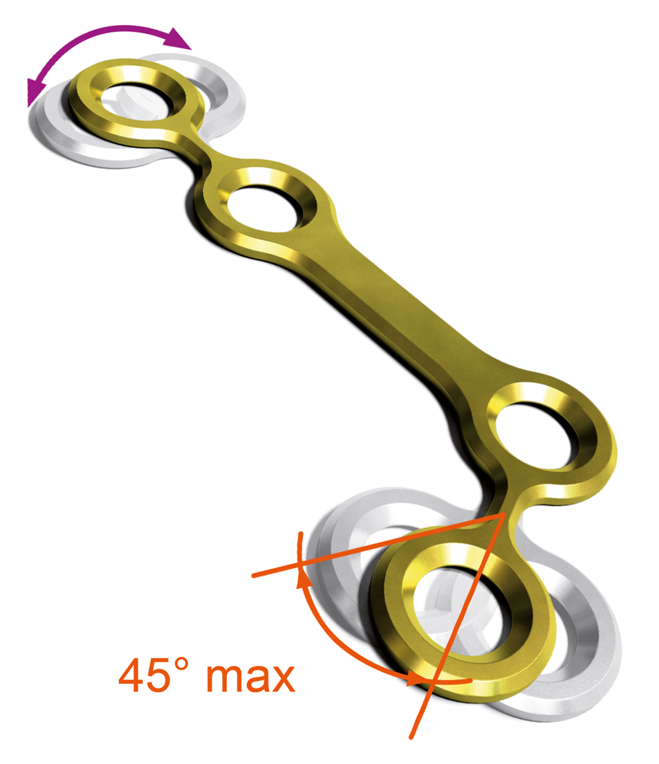Schéma d'une plaque Lefort 1 - Ortrautek