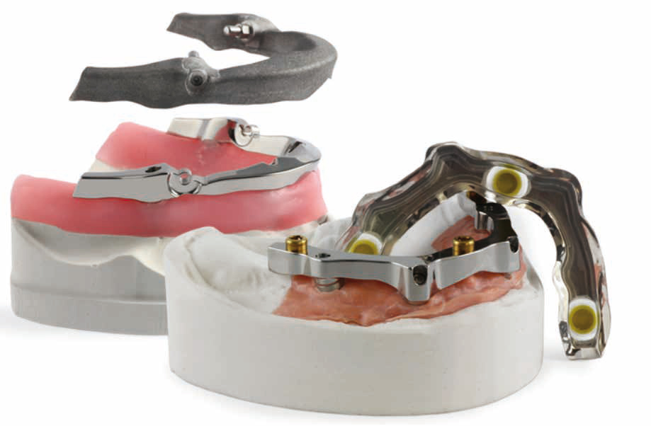 Barres personnalisées Panthera - CAD/CAM