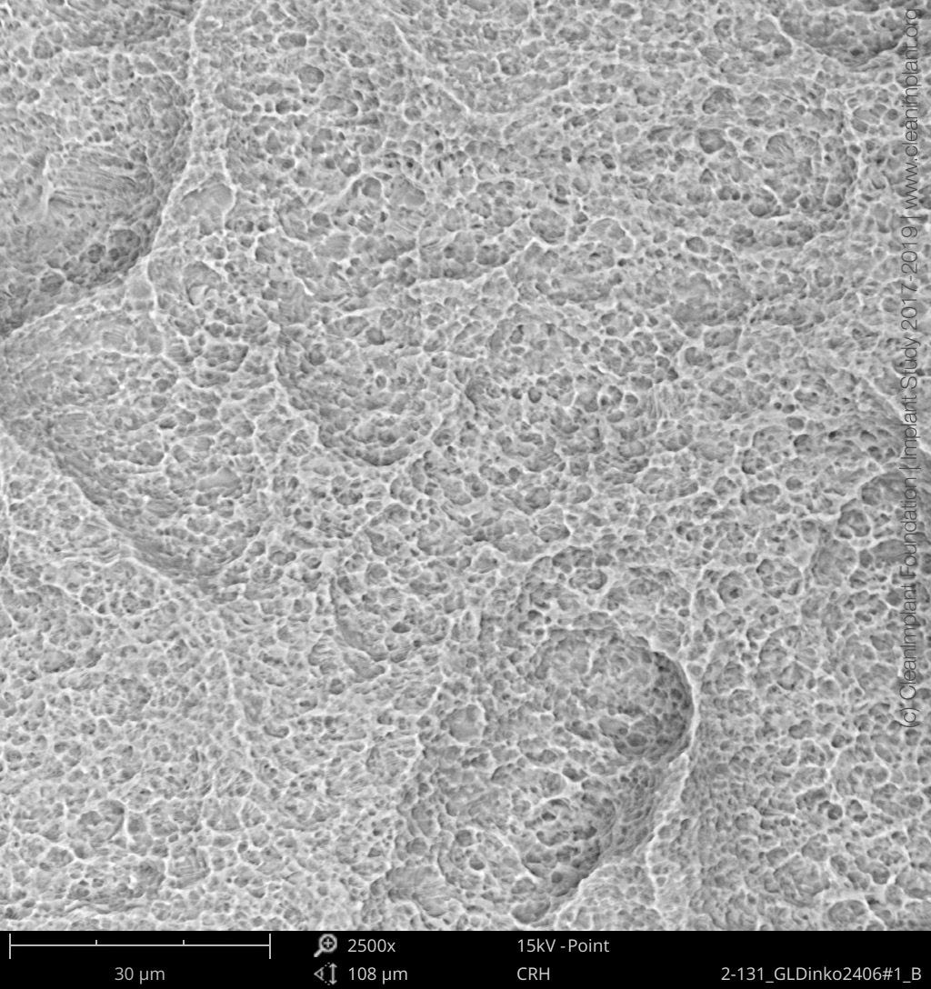 Clean Implant Foundation passe au crible l’implant dentaire In-Kone®