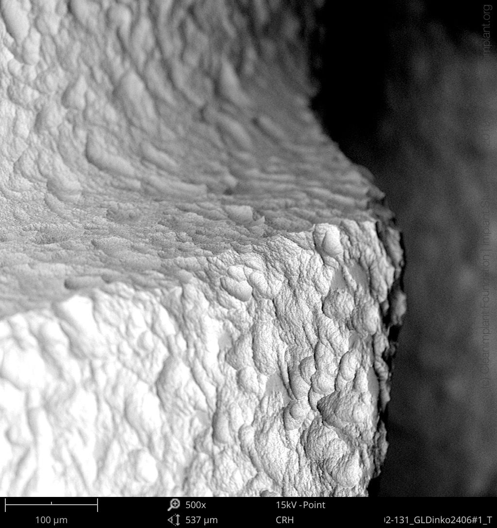 Clean Implant Foundation passe au crible l’implant dentaire In-Kone®