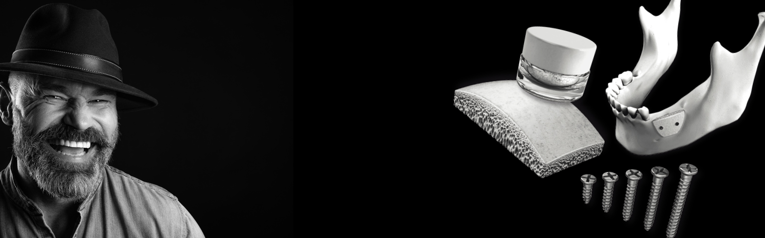 Bone Regeneration Dental Range: discover the different types and the origin of bone grafts for your patients. Just be natural!