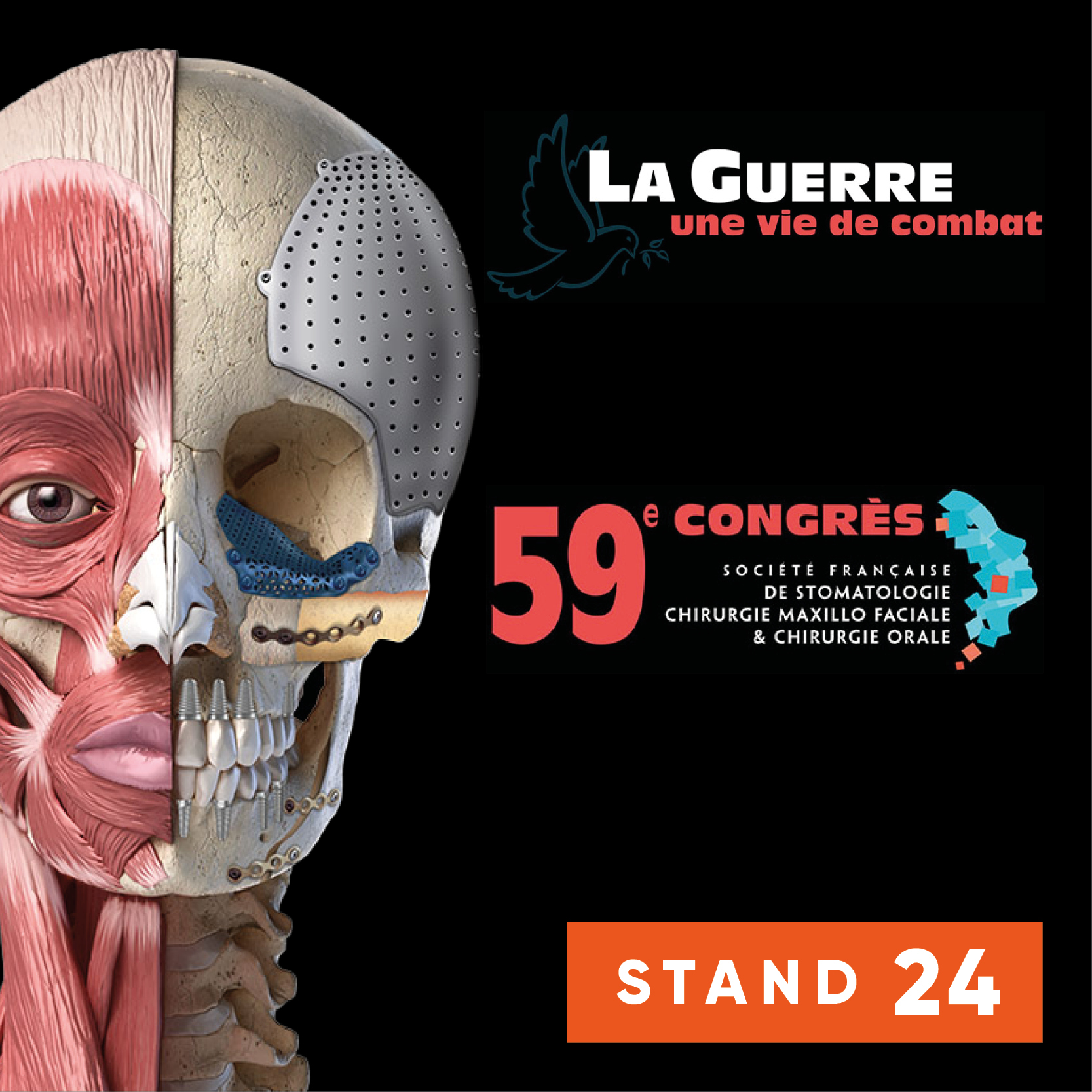 sfscmfso25-detail-carre-actu-site-gd